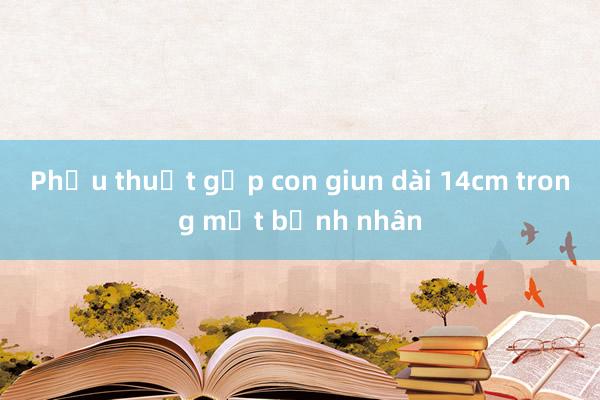 Phẫu thuật gắp con giun dài 14cm trong mắt bệnh nhân